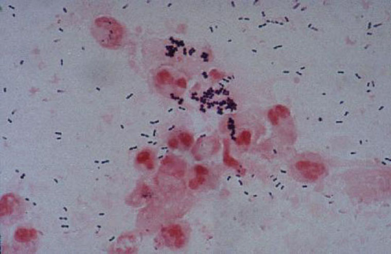 sketchy micro staph aureus sketchy micro staph aureus
