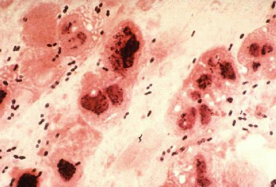 Gram Positive Slide