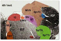 Neuro2.JPG (25148 bytes)