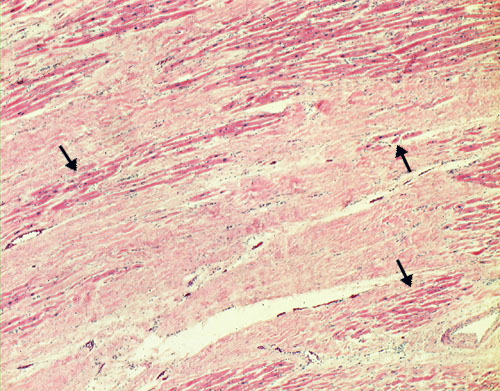 L:\MedEd\Pathology\gross\gross01.html L:\MedEd\Pathology\gross\gross01.html