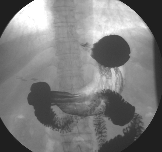 gi and abdomen radiologic anatomy testicular anatomy