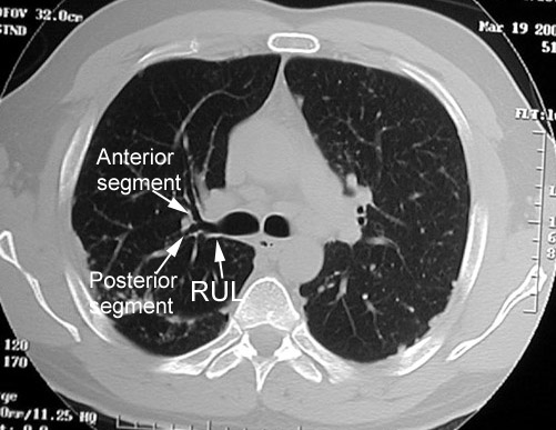 Locate portions of Aorta