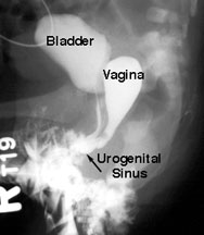 hermaphroditism