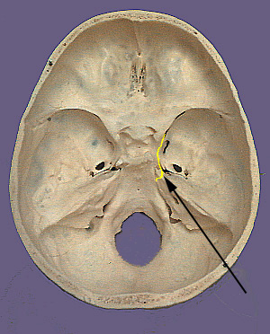 Cranium CN IV
