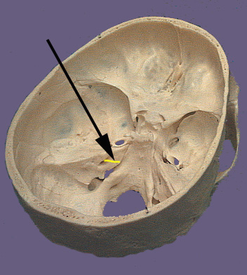 Cranium CN VII
