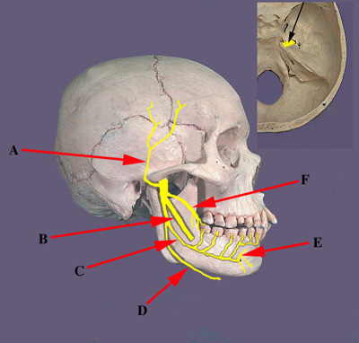 Mandibular Nerve Branches