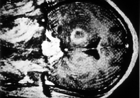Untitled Document [www.meddean.luc.edu]