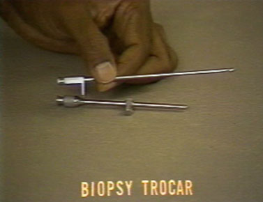 Cope needle