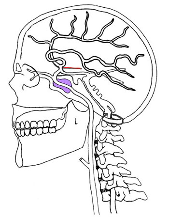 Cervical Carotid