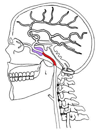 Cervical Carotid