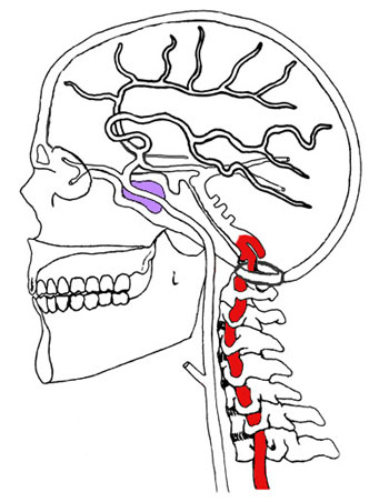 vertebral artery