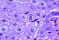 endo.jpg (26223 bytes)