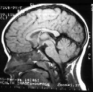 Case 4 - MRI