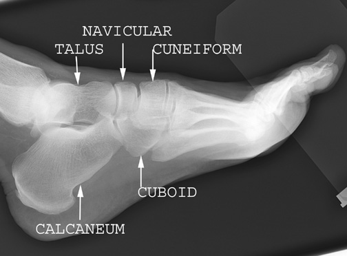 labeled tarsals