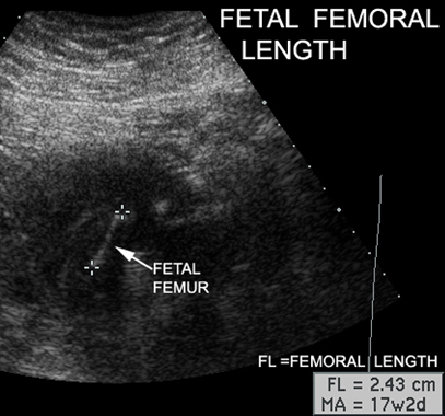 Mammography objectives
